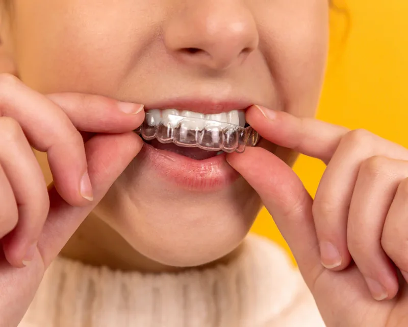 A clear orthodontic aligner