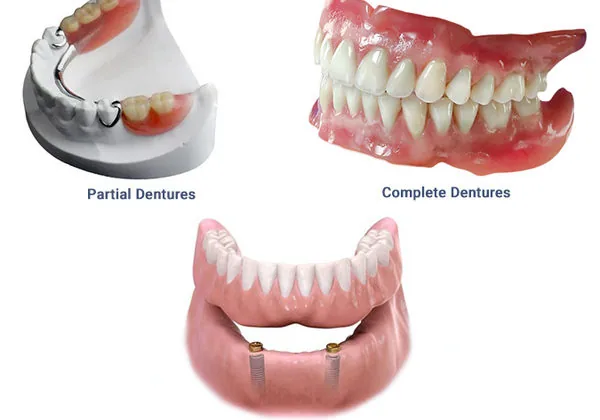 Dentures